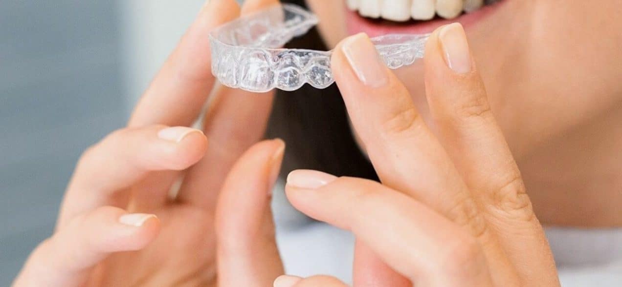 Invisalign Cost image