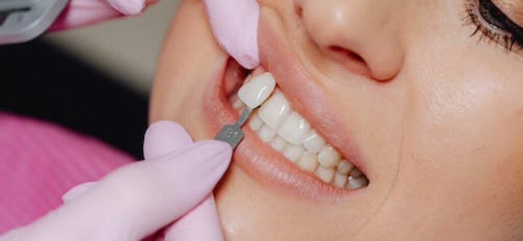 an image of a woman being treated for veneers at big smile dental