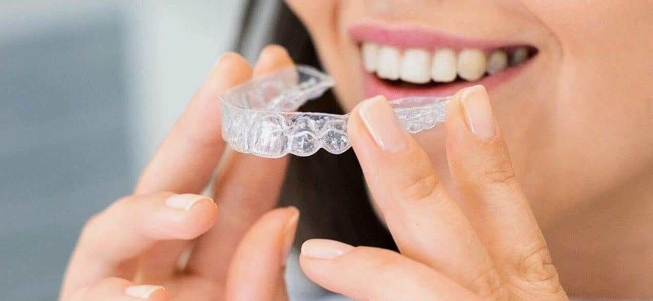 What is the Cost of Clear Braces?