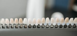 Are dental veneers the perfect solution for crooked teeth?